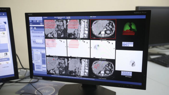sechenovskij-universitet-sozdast-cifrovuju-diagnostiku-raka-legkih-e20dacb