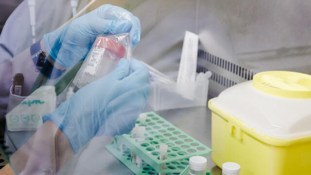 v-cnii-epidemiologii-rasskazali-o-peredache-ospy-obezjan-vozdushno-kapelnym-putem-dd2a6a5