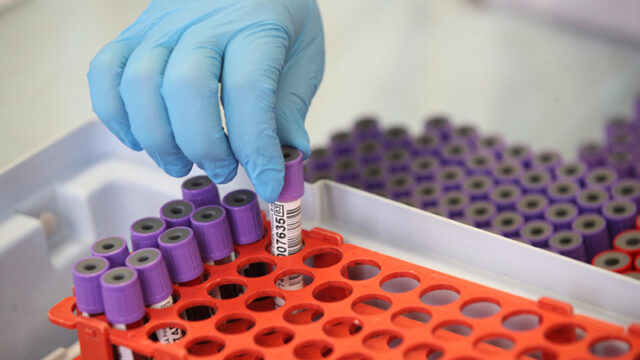 uchenye-sozdali-biodatchiki-dlja-diagnostiki-raka-molochnoj-zhelezy-za-20-minut-32abf47