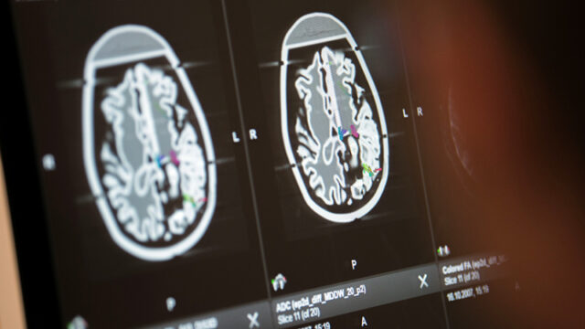 uchenyj-rasskazal-ob-opasnosti-vzhivlenija-implanta-neuralink-v-mozg-cheloveka-665079b