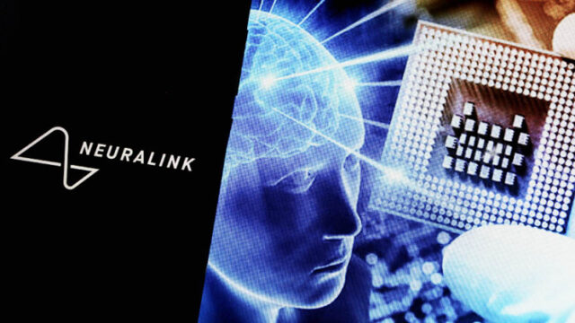 obladatel-implanta-neuralink-arbo-otmetil-rost-ego-effektivnosti-61e8345