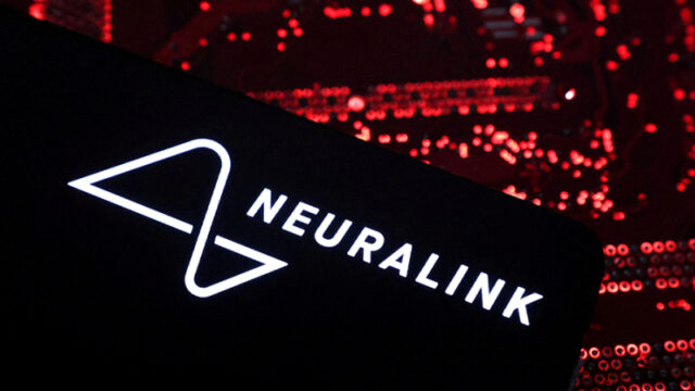 professor-nazval-riskovannym-vzhivlenie-invazivnyh-chipov-neuralink-2b88dc6