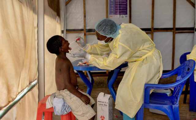rospotrebnadzor-predlozhil-afrike-pomoshh-iz-za-epidemii-ospy-obezjan-ba3090e